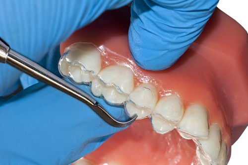Invisalign Sheffield
